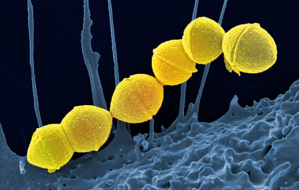 An image showing Strep A