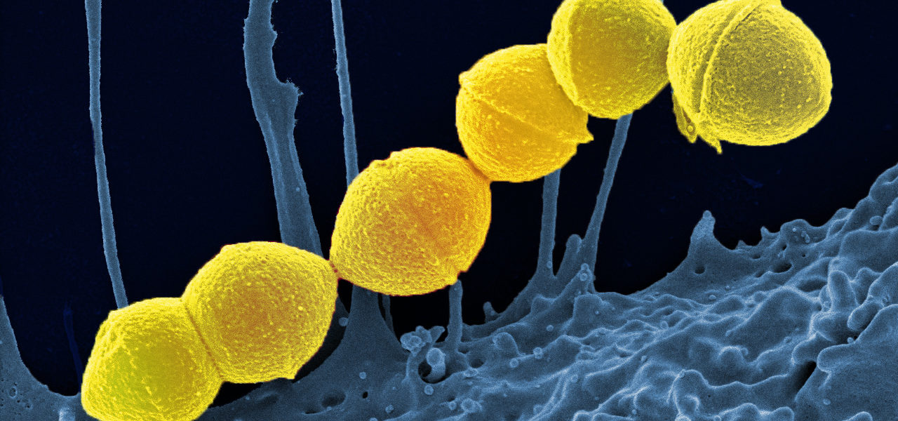 An image showing Strep A