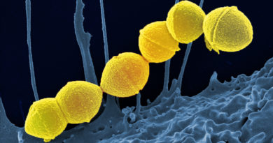 An image showing Strep A